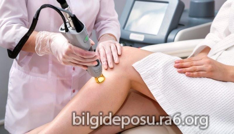 - Bilgideposu