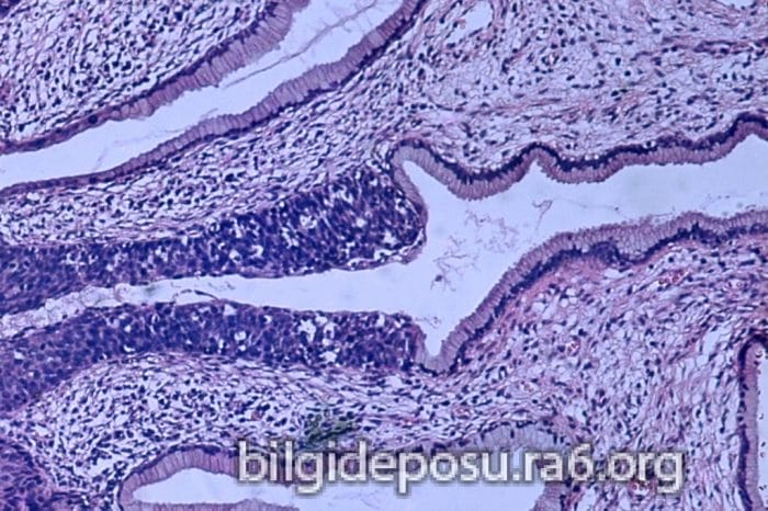Hpv virüsünden kurtulanlar olduğu için içinizi rahat tutmalısınız. 