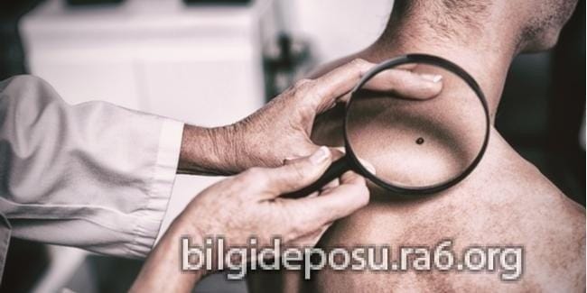- Bilgideposu Cilt kanserinde doğru teşhis hayat kurtarır