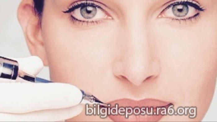 - Bilgideposu