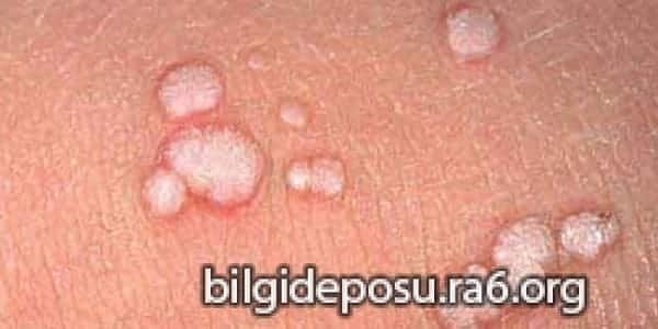 - Bilgideposu