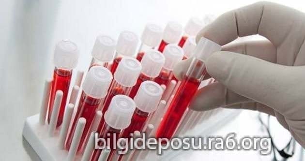- Bilgideposu - Bilgideposu