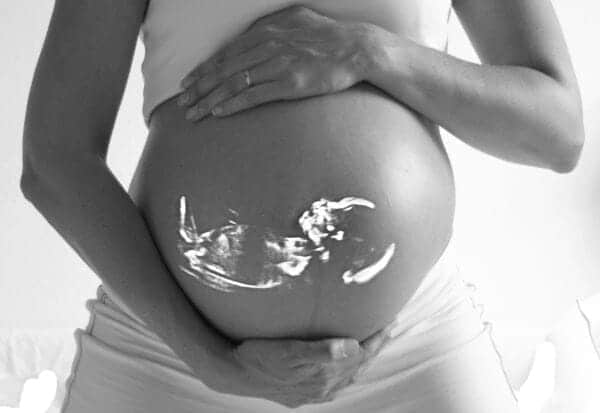 The difference between 3d and 4d ultrasound