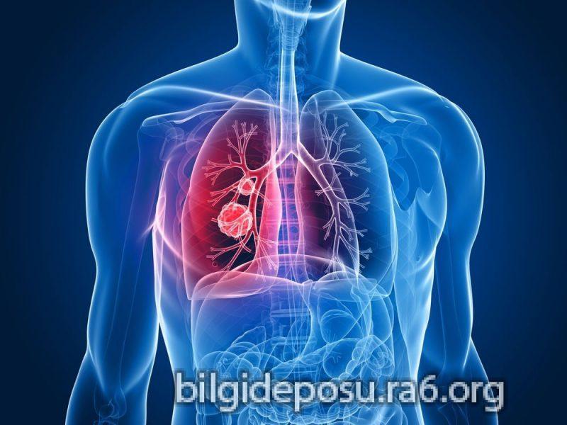 Kanseri ve akciğer kanserinde uygulanan tedavilerin sorgulanması gerekiyor.