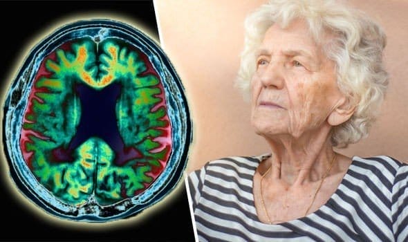 Alzheimer Neden Olur?