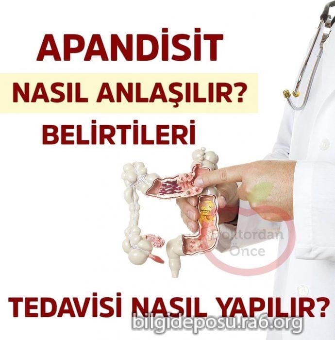 apandisit belirtileri nelerdir - Bilgideposu