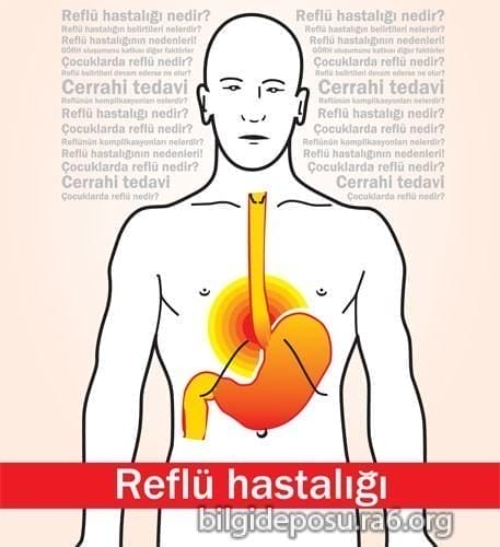 Reflü nedir? Reflü hastalığı belirtileri nelerdir?