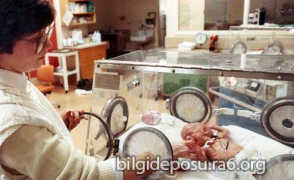 tup bebek fiyatlari tup bebek merkezleri scaled - Bilgideposu